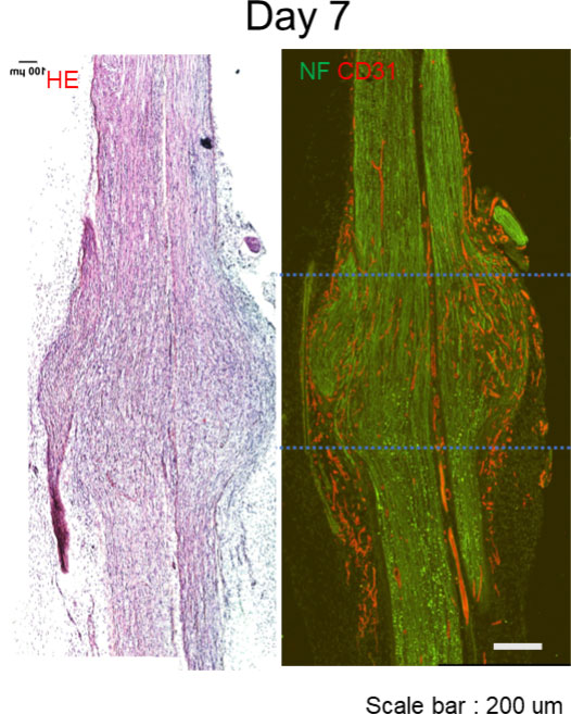 神経損傷後の再生